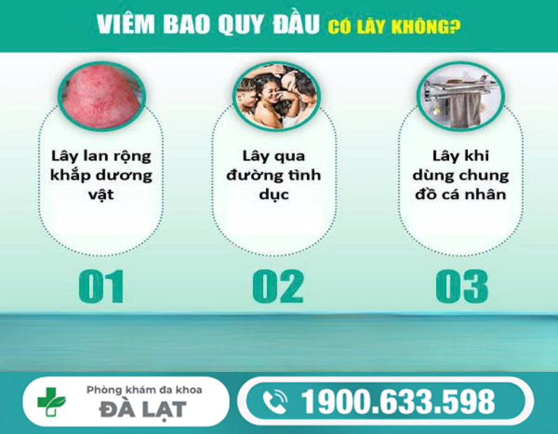 Hình ảnh minh họa